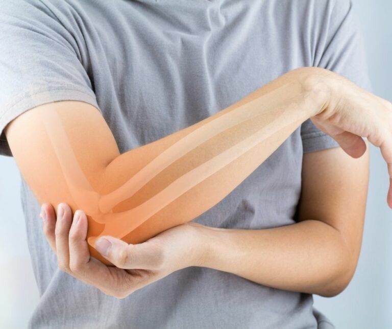 Epicondilitis